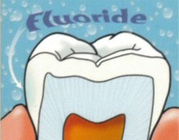 fluoride treatment