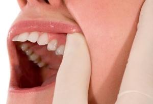 tooth colored composite fillings