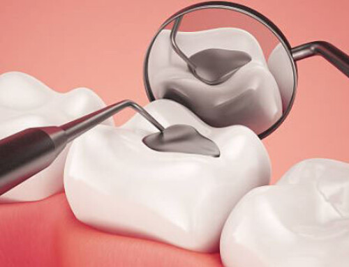 Why Safe Amalgam Removal is Important to Overall Health