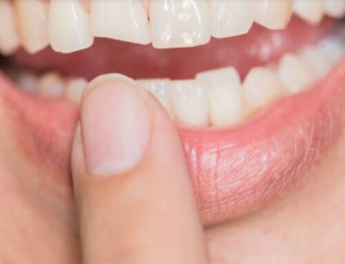 Chipped Tooth Treatment: Immediate Steps and Best Dental Solutions