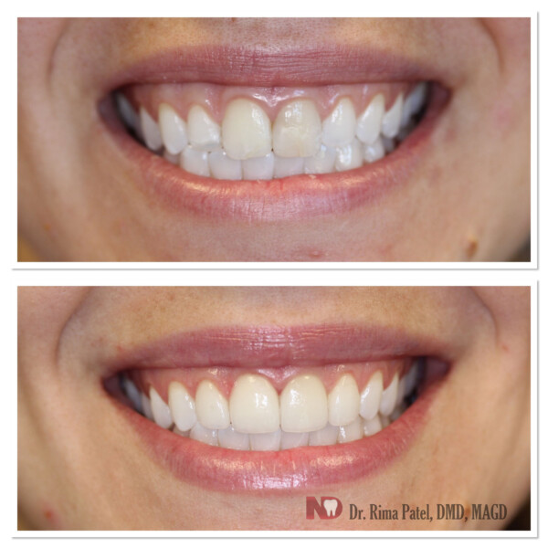 Smile-gallery-C.-M-scaled-1-600×600